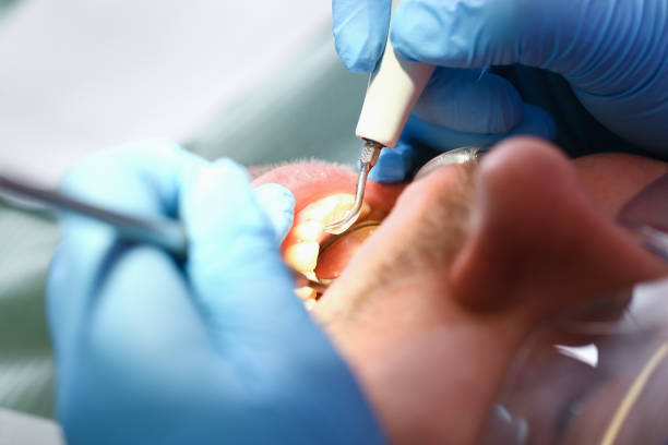 Best Emergency Root Canal Treatment in Gulf Hills, MS